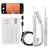 Annalynna Visual Blackhead Remover Tweezers with Camera - 20x Magnification Pimple Popper Tweezers, with 2* Curved Comedone Extractor, Professional Pimple Acne Blemish Removal Tools Kit (6 Pcs Kit)