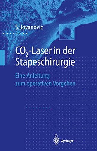 CO2-Laser in der Stapeschirurgie: Eine Anleitung zum operativen Vorgehen (German Edition)