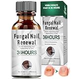 30 ml Tratamiento hongos uñas pies – Solución efectiva que combate la decoloración, antihongos para uñas fáciles de usar,Apoyo para el Cuidado Diario de Hombres y Mujeres