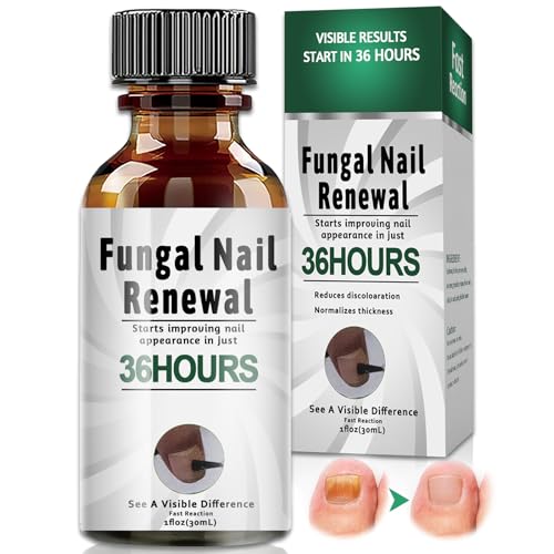30 ml Tratamiento hongos uñas pies – Solución efectiva que combate la decoloración, antihongos para uñas fáciles de usar,Apoyo para el Cuidado Diario de Hombres y Mujeres