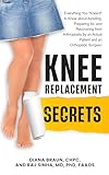 Knee Replacement Secrets: Everything You 