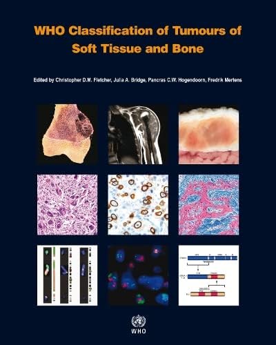 Amazon.in: Buy WHO Classification of Tumours of Soft Tissue and Bone ...