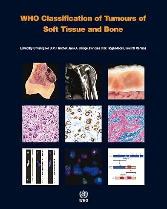 Amazon.in: Buy WHO Classification of Tumours of Soft Tissue and Bone ...