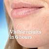 Differin Acne Patches, Pimple Patches for Acne Prone Skin, Formulated with Salicylic Acid and Centella, Fast Triple Action Power Patch for Day & Night, Dermatologist Tested, 36 Count