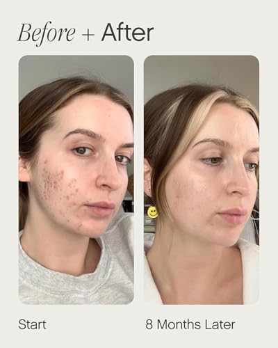 Topicals Faded Brightening and Clearing Serum | Reduces Discoloration, Post-Blemish Marks, Scars and Spots | Contains Kojic Acid and Niacinamide | Dermatologist-tested, Vegan, Cruelty-Free (0.5 Fl Oz) - Thumbnail 4