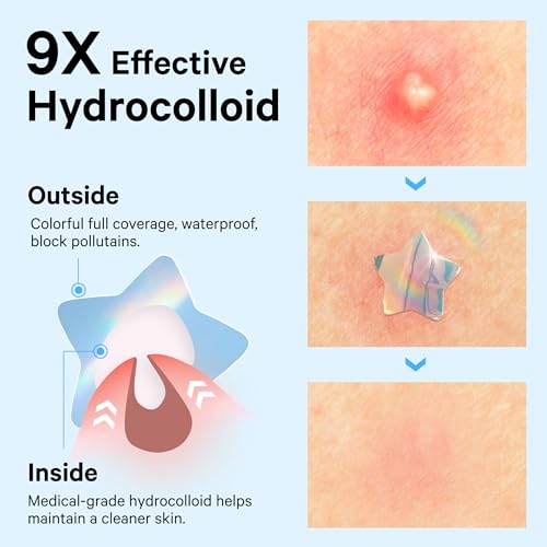 Image of Sosky Hologram Pimple Patches for Face, Hydrocolloid Acne Patches with Salicylic Acid, Cute Star Zit Stickers,Colorful Blemish Covers,48 Count Blue Star Cloud