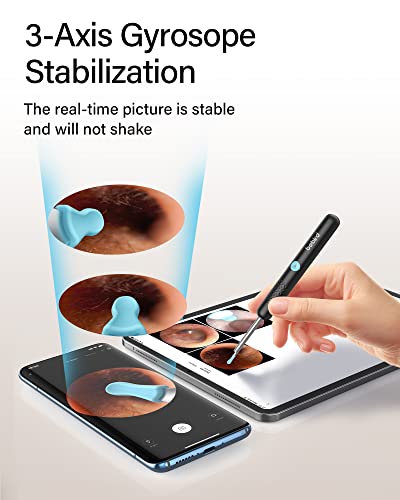 Ear Wax Removal Tool,Bebird Ear Wax Removal Ear Camera,Ear Cleaning Camera,1080P Hd Endoscope, Wireless Ear Cleaner Tools With 6 Led Lights Waterproof Ear Scope Compatible With Iphone & Android Phones #TOP3