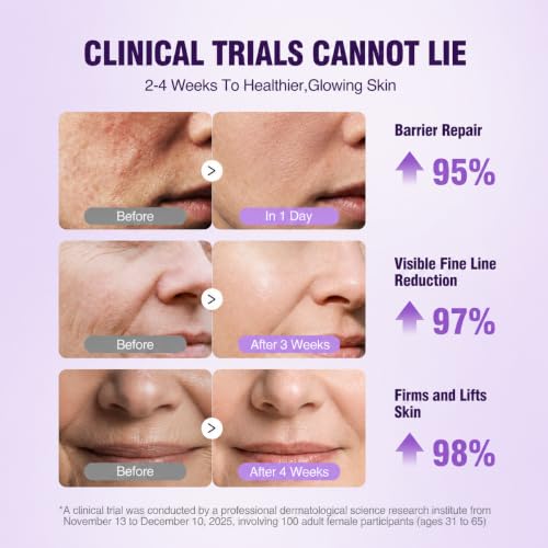 Image of Retinol Peptide Serum for Face & Neck with NAD+ Support,Firming Collagen Skin Care for Fine Lines, Wrinkles & Hydration, Lightweight Daily Serum for Women & Men, 1.7 Fl Oz