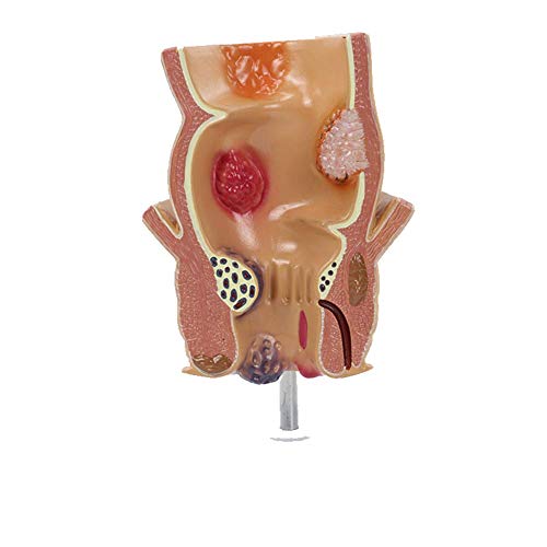 Erziehungswissenschaftliches Modell Rektales Modell Dickdarm-Demonstrationsmodell Lehre Medizinische Anorektale Medizin Lehre Cover