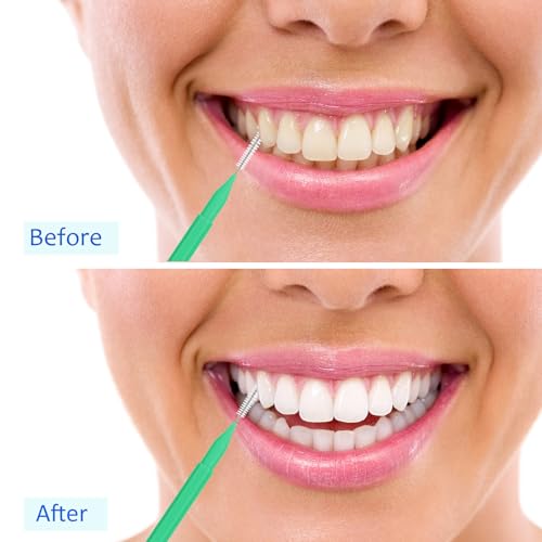 Image of Patelai 100 Pieces Braces Dental Brush for Cleaner Interdental Toothpick Dental Tooth Flossing Head Oral Hygiene Flosser Toothpick Cleaners Tooth Tool(Assorted Colors,Various Sizes)
