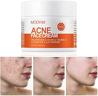 Acne Treatment for Face, Salicylic Acid Acne Cream Back Acne Treatment Cream for Teens & Adults Anti-acne Moisturizer Pimple Cream Butt Acne Clearing Cream, Acne Spot Treatment for Breakouts Blemish