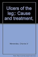 Ulcers of the leg;: Cause and treatment, B0006BOJLE Book Cover