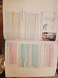 EKG Plain and Simple