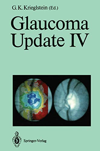 Glaucoma Update IV view 2