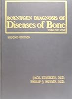 Roentgen diagnosis of diseases of bone 0683027484 Book Cover