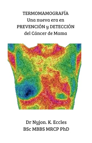 TERMOMAMOGRAFÍA: Una nueva era en PREVENCIÓN y DETECCIÓN del Cáncer de Mama (Spanish Edition)