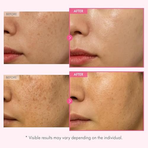 Image of Arbutin 7% Glutathione Brightening Cream 100 ml 70,000 ppm Arbutin + 5,001 ppm Glutathione with Niacinamide Dark Spot, Pigmentation & Uneven Tone Care Korean Skin Care (Pack of 2)
