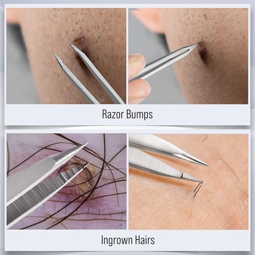DUROX 3-Piece Tweezers Set