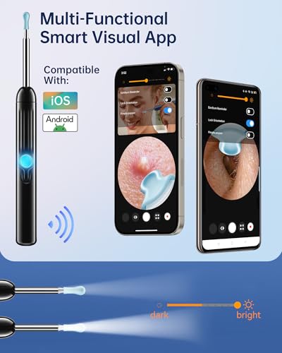 Image of Jegoat Ear Wax Removal, 1080P HD Scope and 6 LED Lights, Ear Cleaner with Camera, Ear Cleaning Kit - Earwax Remover Tool with 5 Spoon (Onyx)