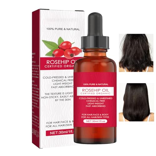 de Rosa Mosqueta ORGÁNICO Prensado en Frío - 100% Puro de Rosal Silvestre | Aceites Facial contra Arrugas y Cicatrices | Nutritivo para Piel, Cabello y Uñas, Reduce las Estrías