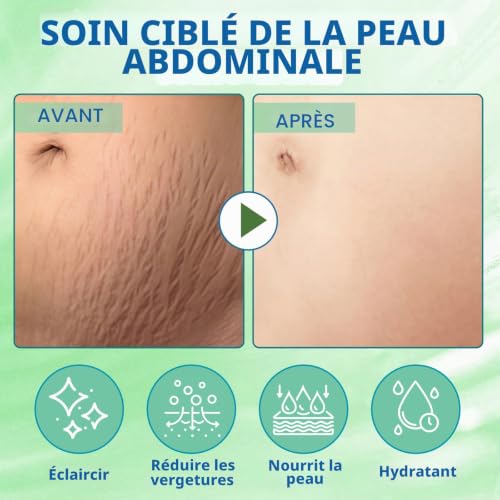 3 Pièces 70g Masque Tissu Ventre, Patch Abdominal Soin Anti-Vergetures Hydratant, Aide À Maintenir La Souplesse Et Élasticité De La Peau, Routine Beauté Relaxante – vue 2