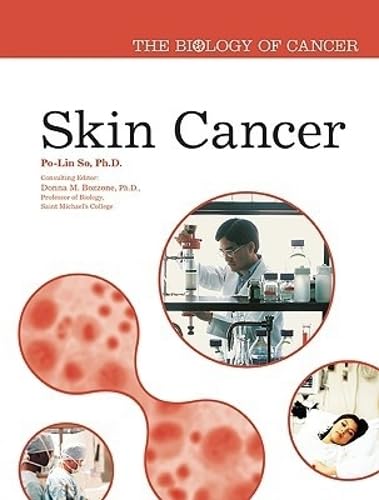 Skin Cancer (The Biology of Cancer)