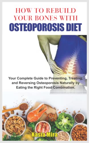 How To Rebuild Your Bones With Osteoporosis Diet: Your Complete Guide To Preventing, Treating, And Reversing Osteoporosis Naturally By Eating The Righ