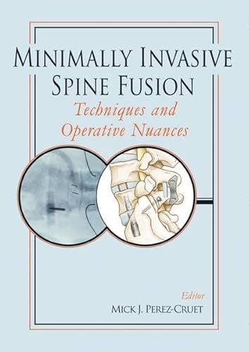 Preisvergleich Produktbild Minimally Invasive Spine Fusion: Techniques and Operative Nuances