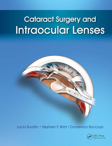 Cataract Surgery and Intraocular Lenses