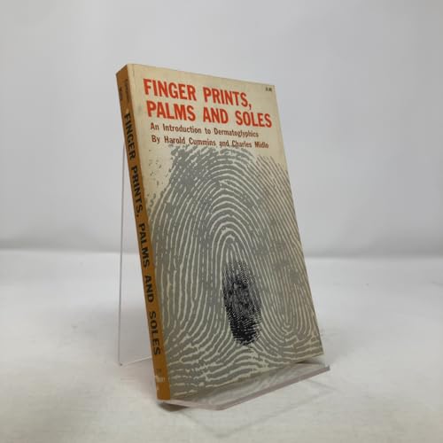 Finger prints, palms and soles: An introduction to dermatoglyphics
