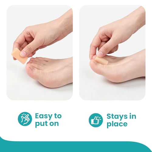 Image of Silicone Toe Protectors - 12 Pack Silicone Toe Sleeve for Hammer Toes, Corns, Calluses, Blisters - Soft Gel Toe Tube Pads for Pain Relief(Multi Size, Beige)