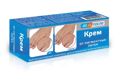 Hand Cream Against Age Spots 50 Ml