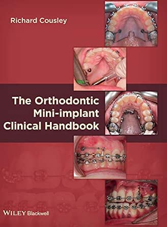 The Orthodontic Mini–implant Clinical Handbook-Wow! eBook