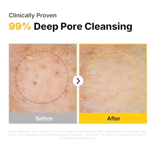 MANYO Pure Cleansing Oil, Natural Oil Cleanser for Face, Makeup Blackhead Remover, Korean Skin Care, 6.76 fl oz (200ml) - Image 6