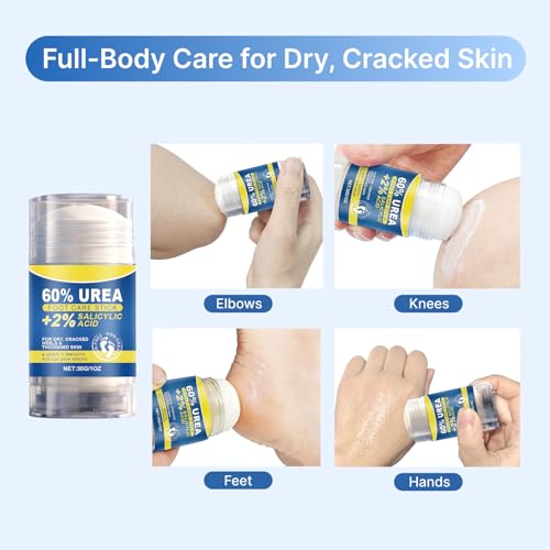 Generic 60% Urea + 2% Salicylic Acid Urea Foot Care Stick, Callus Remover Foot Cream for Dry Cracked Heels, Fast Absorbing Non Greasy Heel Balm Moisturizer for Feet, Knees & Elbows (3 PACK)