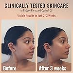 ADM Anti Aging Pure Retinol Serum For Face with Niacinamide - Resurfacing, Smoothing Fine Lines, Wrinkles, Acne Scars - Moisturizing Facial Skincare Treatment for Sensitive Skin - 1oz - Image 3