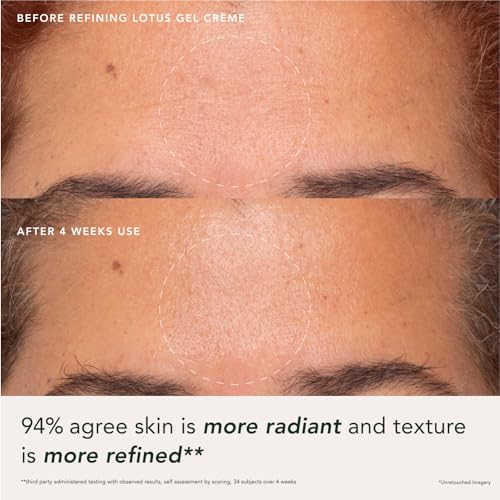 RANAVAT-Imperial-Glow-Refining-Lotus-Gel-Creme-Hydrating-Gel-Moisturizer-Pore-Minimizer-Improves-Radiance-Texture-with-Hyaluronic-Acid-Floral-Ketoacids-17-oz