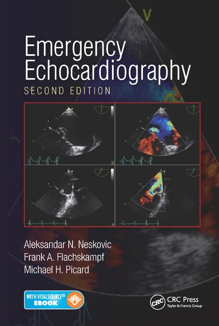 Emergency Echocardiography