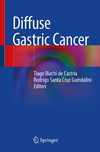 Diffuse Gastric Cancer view 2