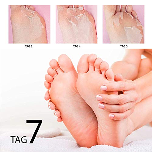 FLUXC® Happyfeet FootMask Voetmasker voor het verwijderen van eelt, met aloë vera, eeltverwijderaar, voetpeeling masker… - Afbeelding 5