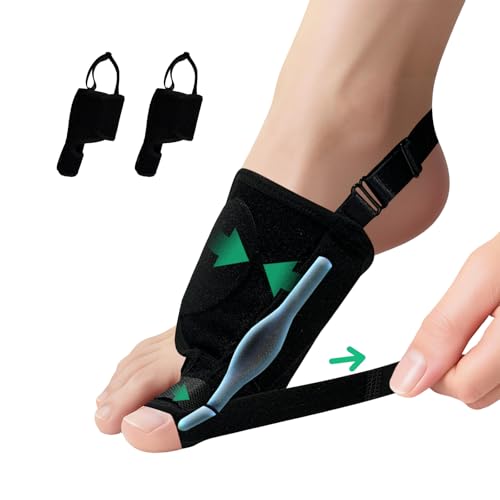 GIMCALO Lot de 2 correcteurs d'oignon pour femme, séparateur de gros orteil, soulagement de la douleur, redresseur d'orteil, correction non chirurgicale de l'hallux valgus, attelle orthopédique pour