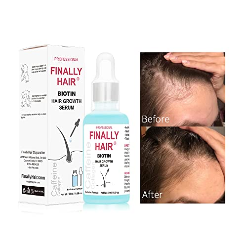 Finally-BIOTIN-CALLOGEN-CAFFEINE-Hair-Growth-HAIR-LOSS-TREATMENT-SERUM-Grow-Your-Hair-Back-PROMOTES-HAIR-GROWTH-for-Women