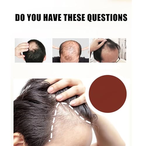 Image of Kormesic Professional Hair Care, 5% Hair Growth Scalp Massage Cream, Fast Regrowth & Strengthens Hair Roots, for Men & Women (3PCS)