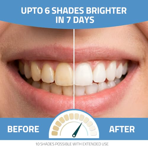 Image of Xwhite 7 Day Teeth Whitening Kit -14 Strips - Halal Certified, Vegan, Pap+, Alcohol-Free, Peroxide-Free, Dissolving Strips for Sensitive Teeth (Advanced Whitening)