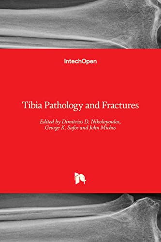 Tibia Pathology and Fractures view 2