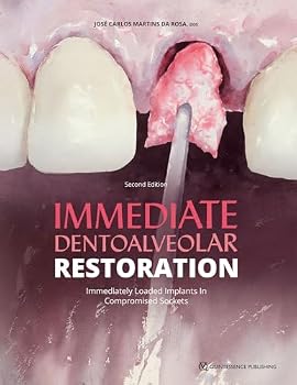 Hardcover Immediate Dentoalveolar Restoration: Immediately Loaded Implants in Compromised Sockets, 2nd Edition Book