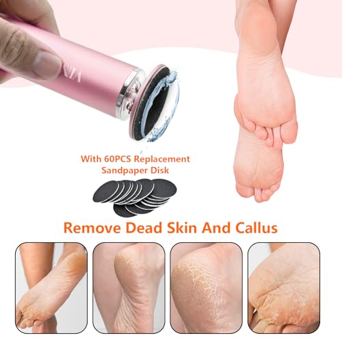 Electric Foot File Remover Callus, Professional Adjustable Speed Foot File Grinder with 60pcs Replacement Sandpaper Disks for Men & Women - for Dead Skin, Calluses, Dry & Cracked Feet (Gold)