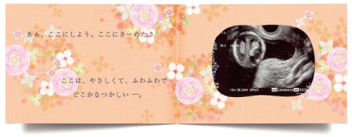 色褪せないエコー写真の保存方法 人気アルバム7選とお得な無料キャンペーン