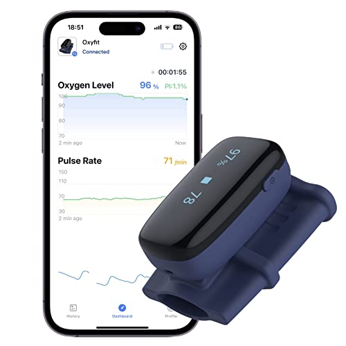 The 9 Best Pulse Oximeter For Overnight Monitoring With Alarm in 2023 Compare the Market