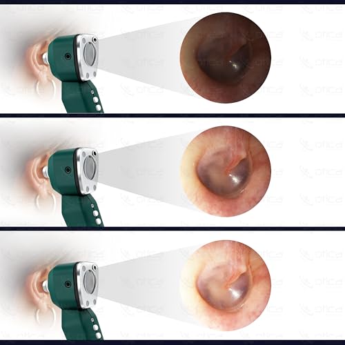 Image of OTICA 3.7V Professional Diagnostic Pocket LED Otoscope | Rechargeable In-Built 3500mAh Battery | Type-C Charging | Adjustable Intensity | 10 Disposable Specula + Spare Glass | 11707 - Green